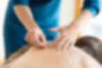 woman receiving acupuncture
