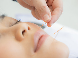 facial rejuvenation acupuncture treatment 