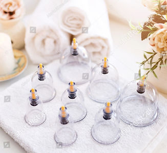 cupping set